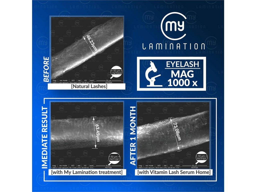 My Lamination vysledky